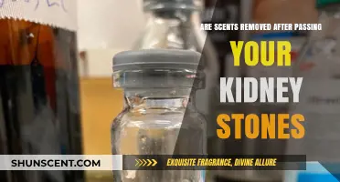 Kidney Stones Gone: Do Unpleasant Scents Disappear After Passing?