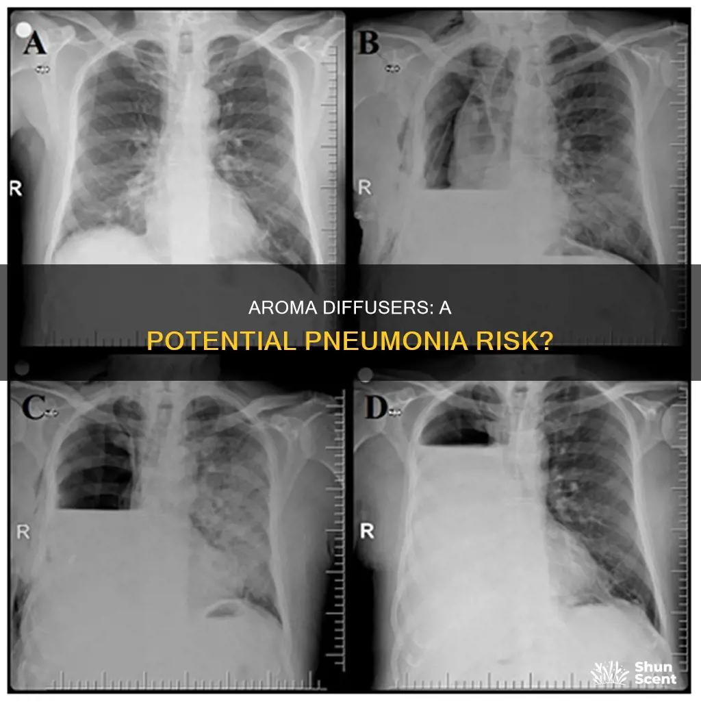 can a aroma diffuser cause pneumonia