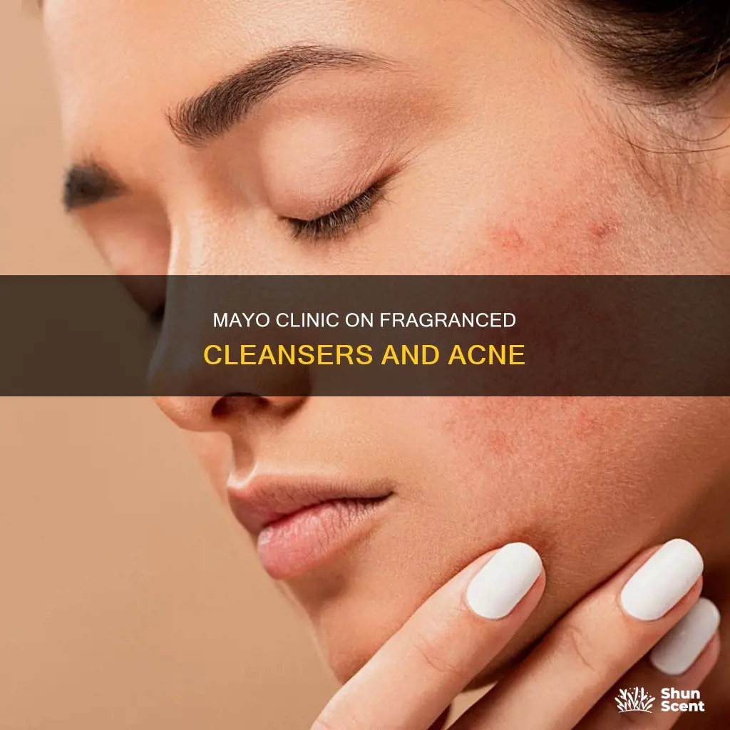 can a cleaning wash with fragrance cause acne mayo clinic