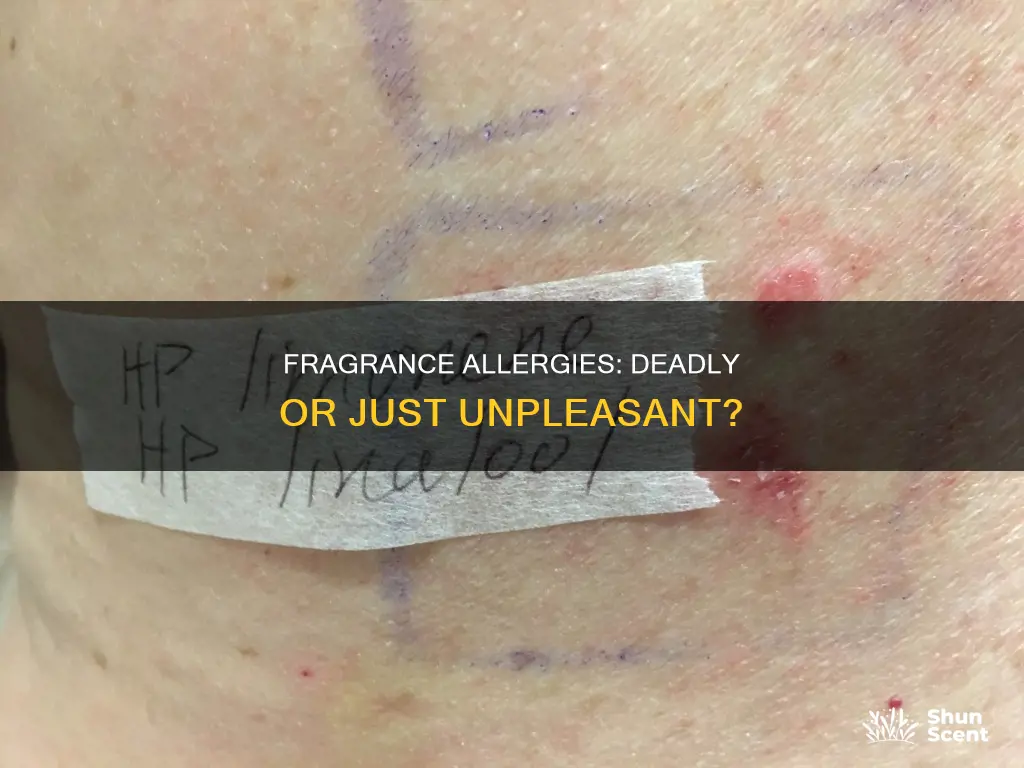 can a fragrance allergy kill you