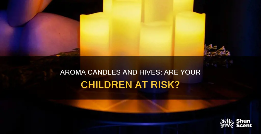 can aroma candles cause hives in children