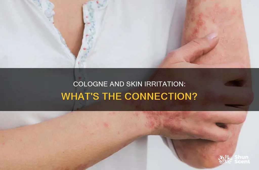 can cologne irritate skin