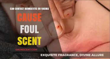 Can Vaginal Contact Dermatitis Lead to Unpleasant Odor? Find Out