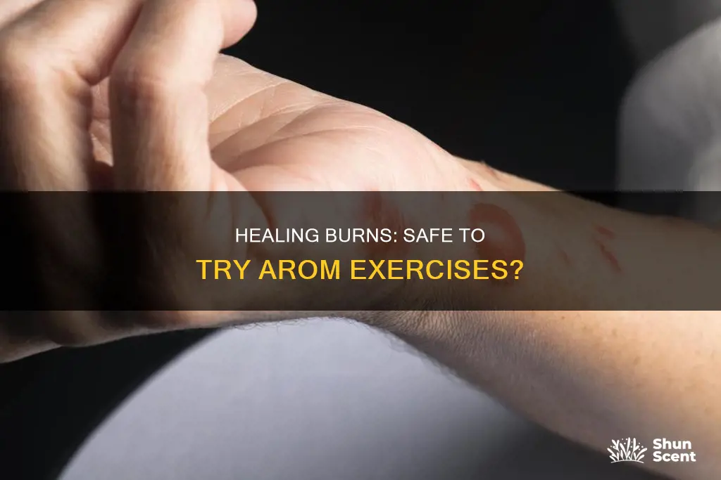 can I do arom exercises with my healing burn