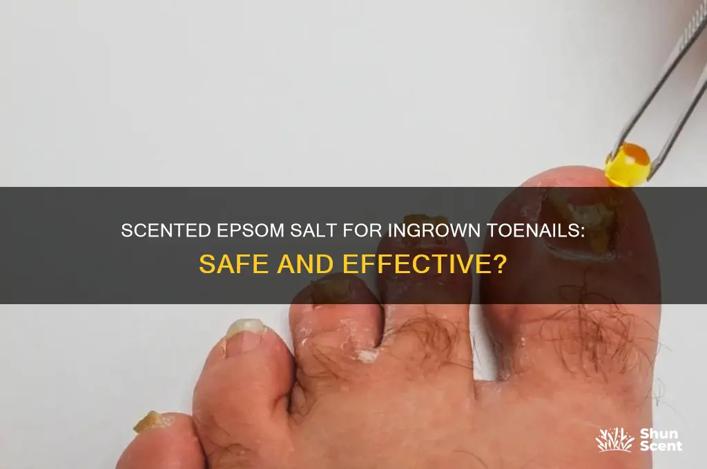 can i use scented epsom salt for ingrown toenail