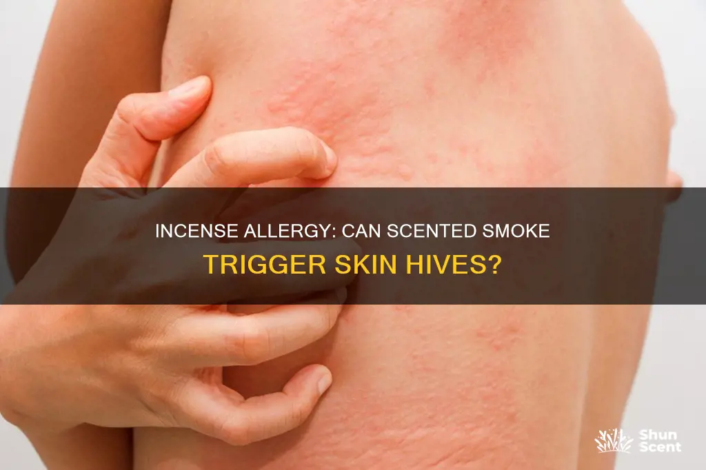 can incense cause me to break out in hives