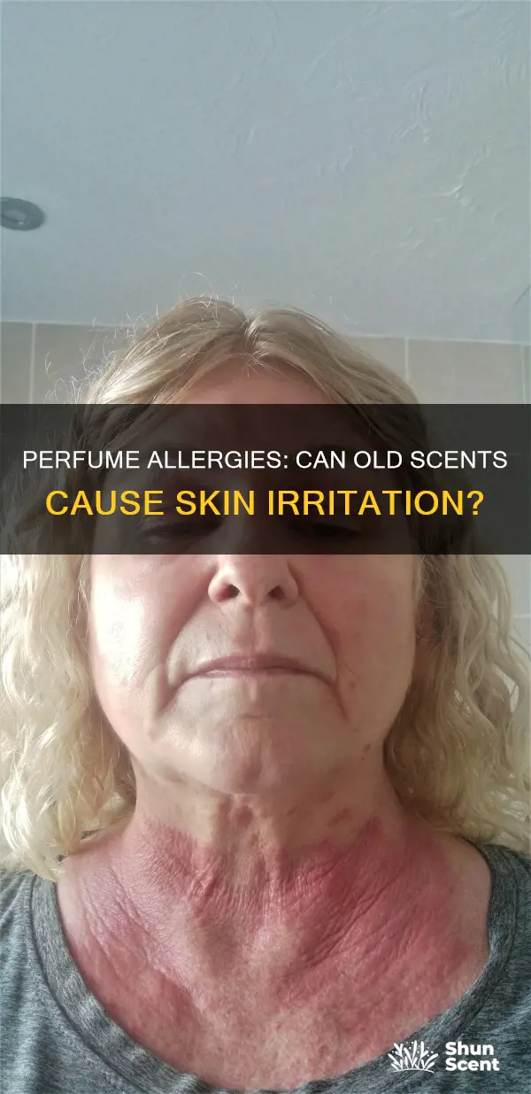 can old perfume cause a rash