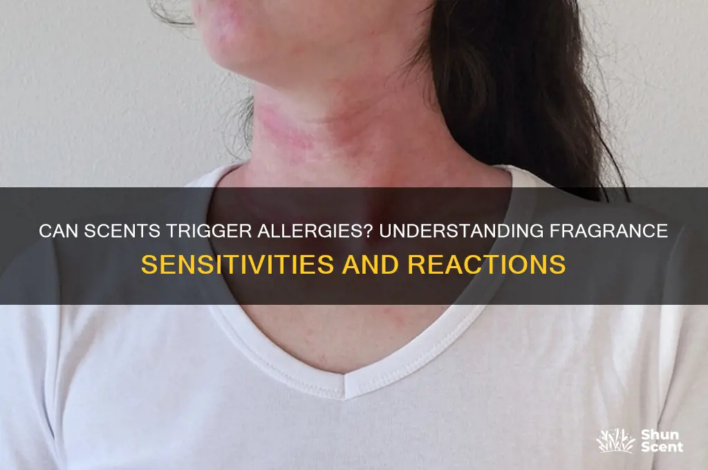 can people be allergic to scents