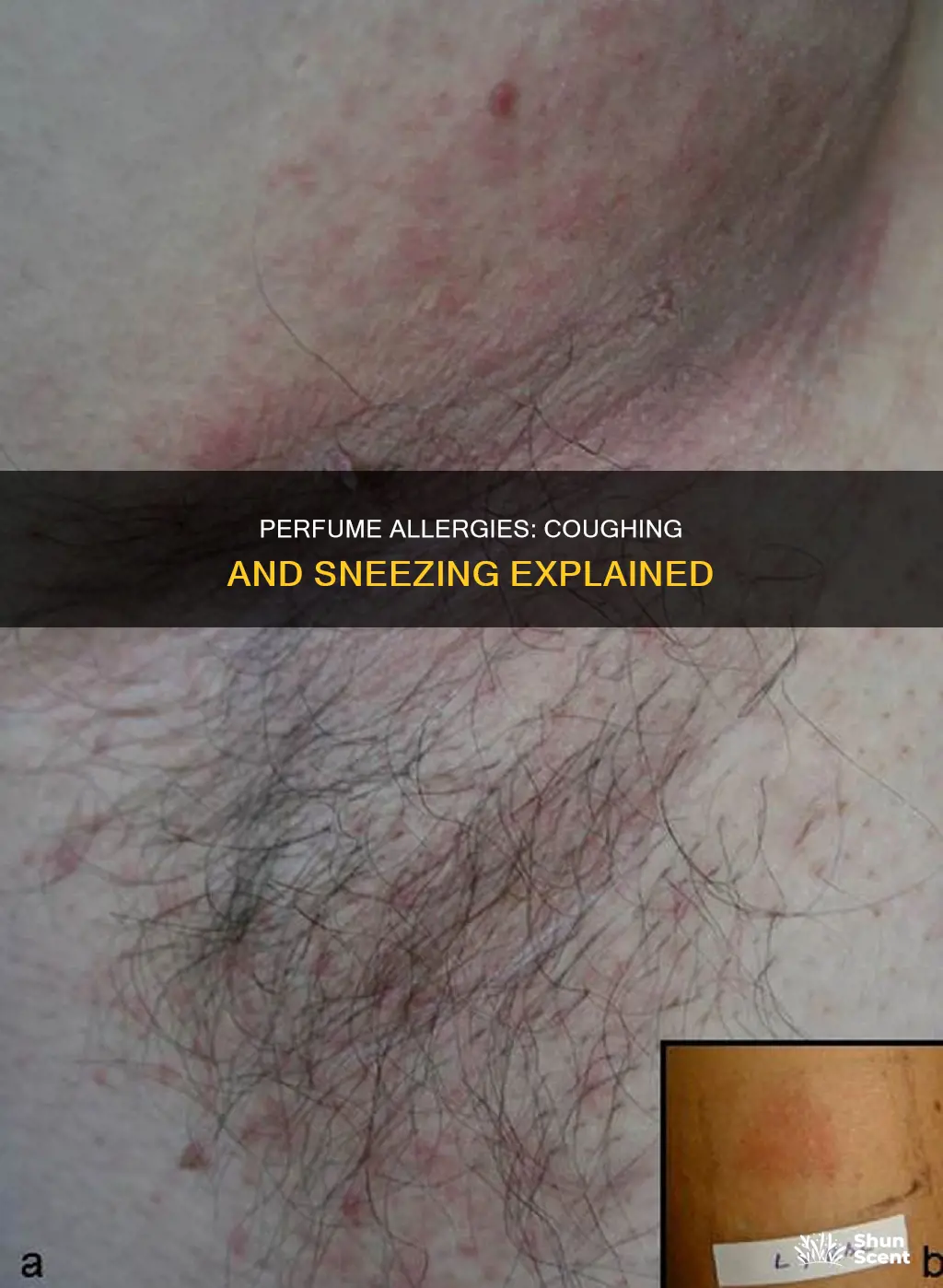 can perfume allergy cause cough