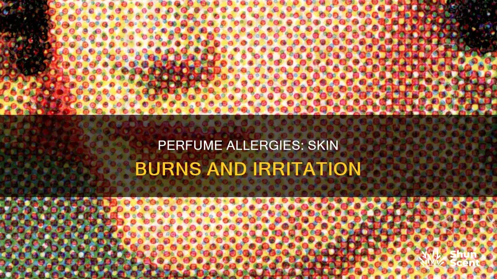 can perfume burn your skin