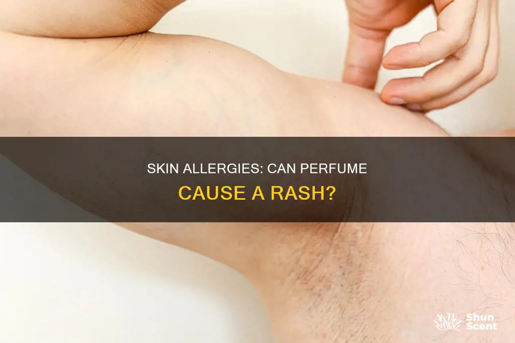 can perfume cause a rash