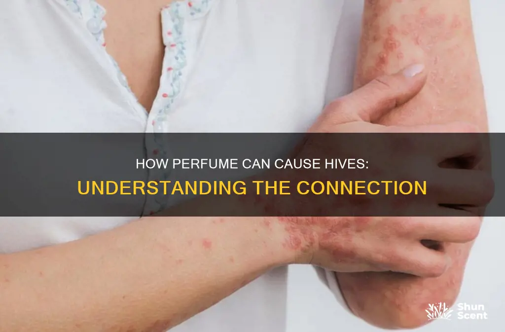 can perfume cause hives