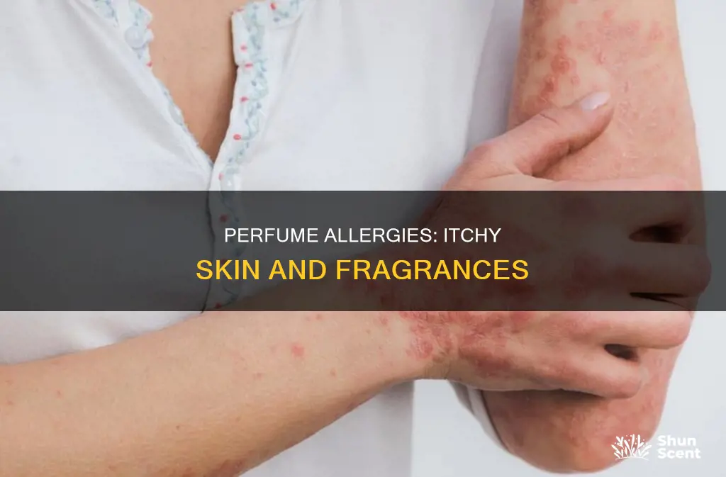 can perfume cause itchy skin