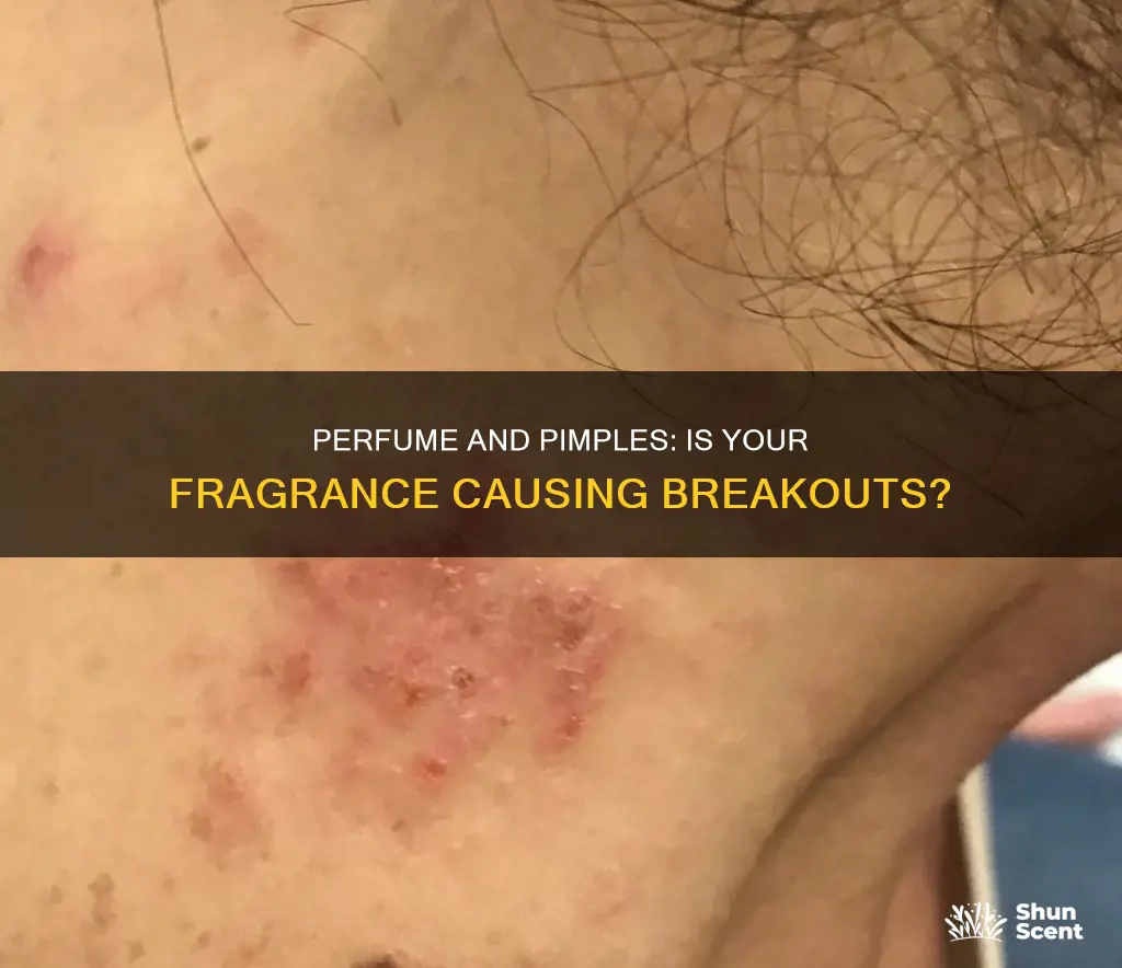 can perfume cause pimples on neck