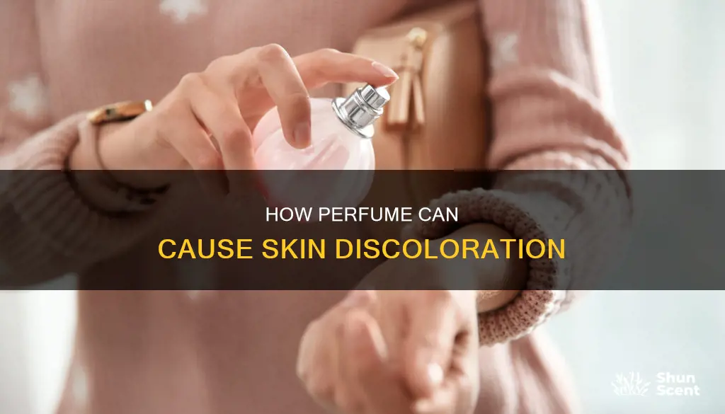 can perfume cause skin discoloration