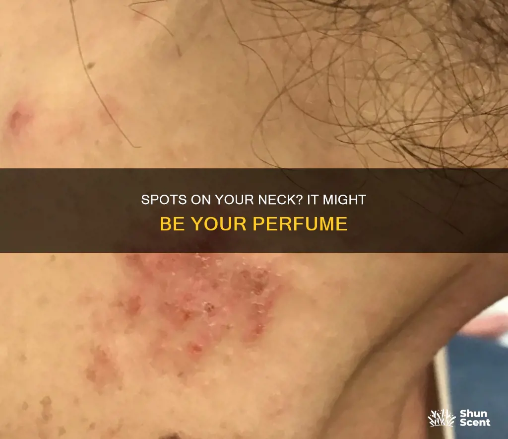 can perfume cause spots on neck
