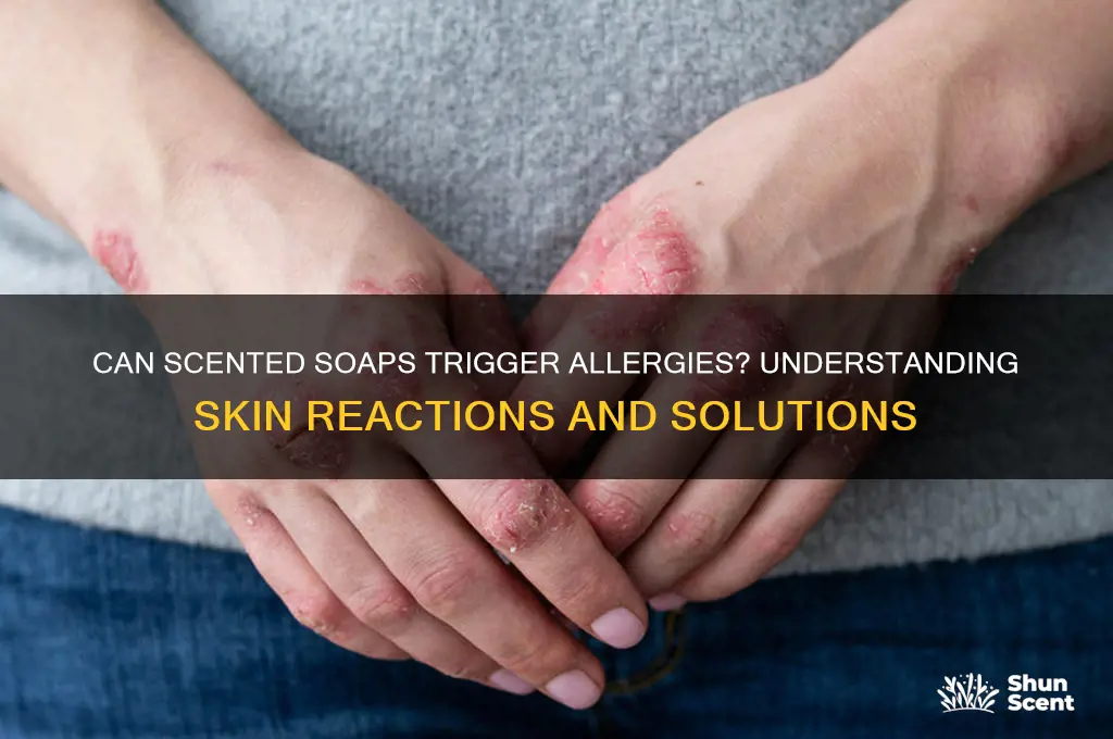 can scent soap cause allergy