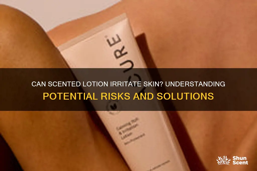 can scented lotion irritate skin