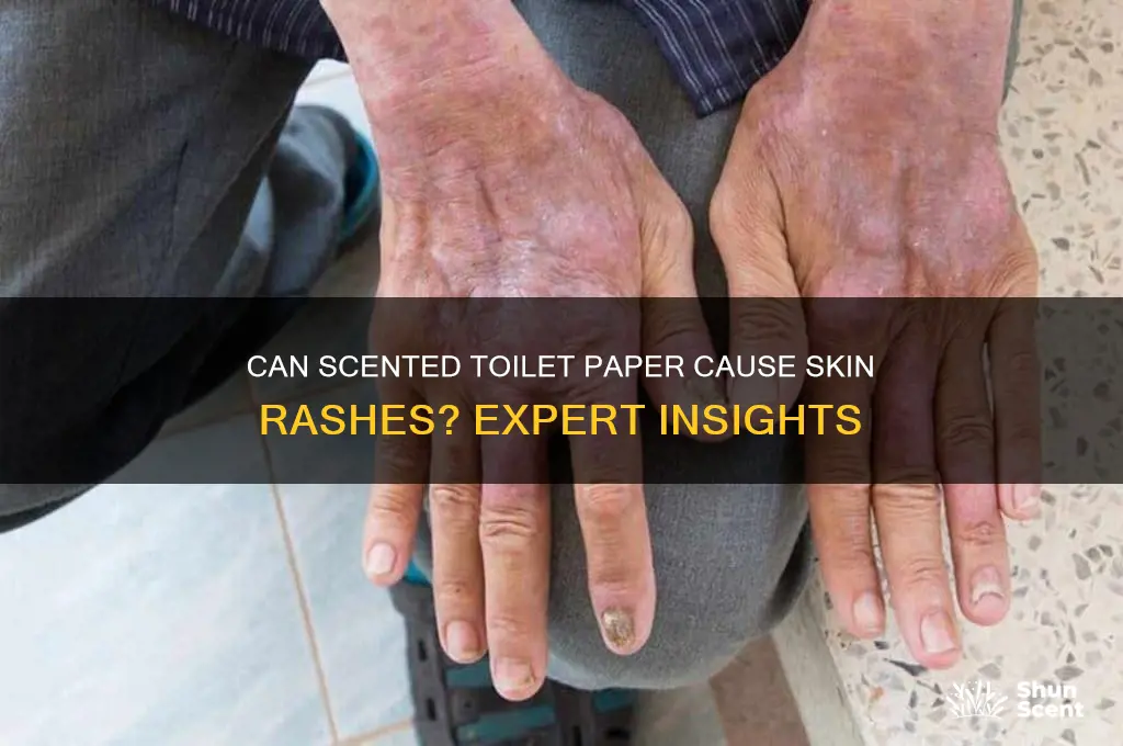 can scented toilet paper cause a rash
