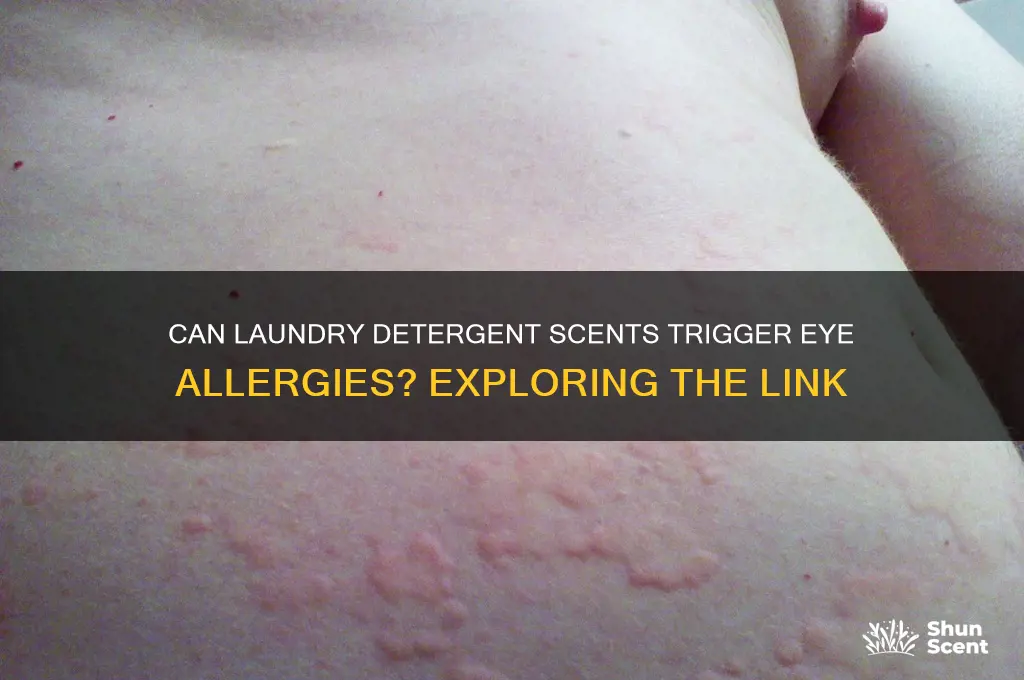 can the scent of laundry detergent cause eye allergy