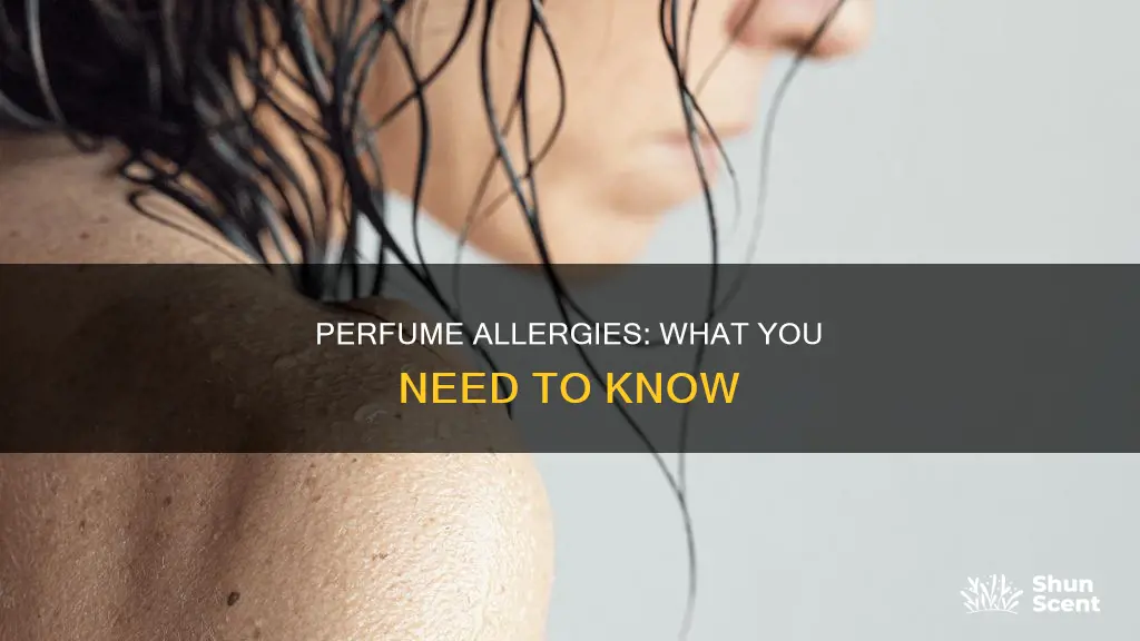 can u be allergic to perfume