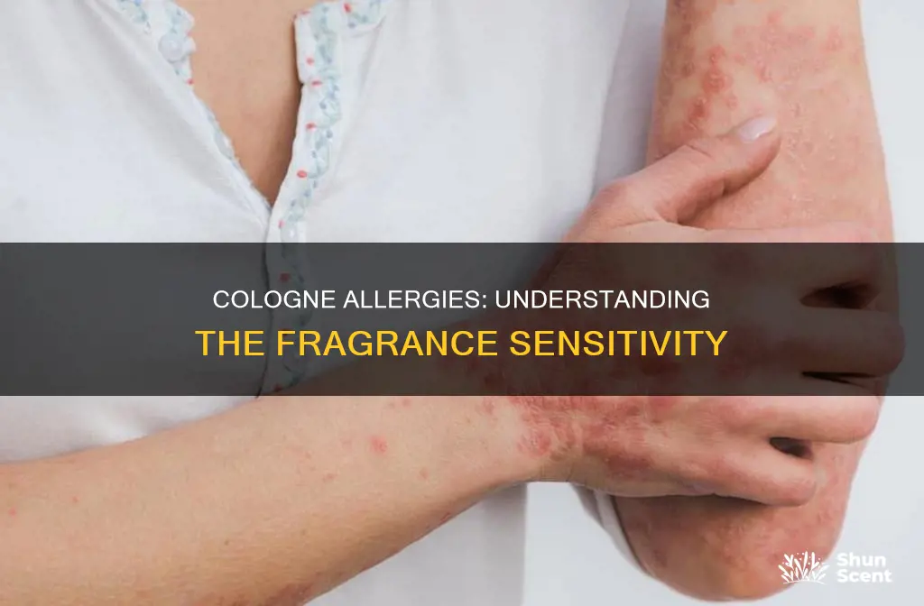 can you be allergic to cologne