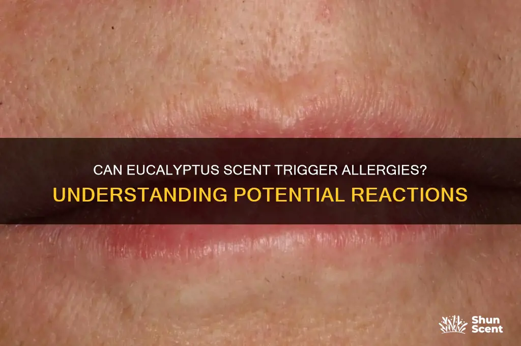 can you be allergic to eucalyptus scent