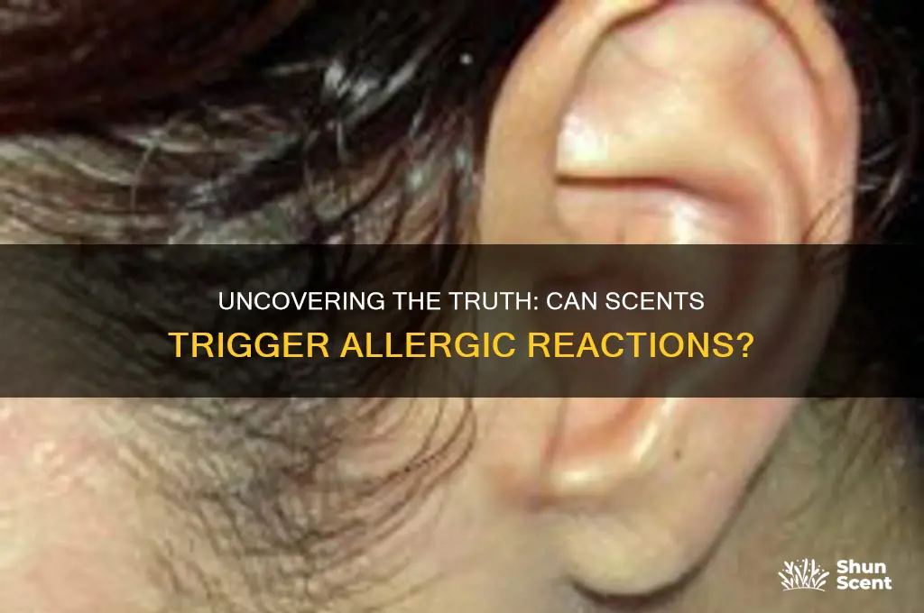 can you be allergic to scents