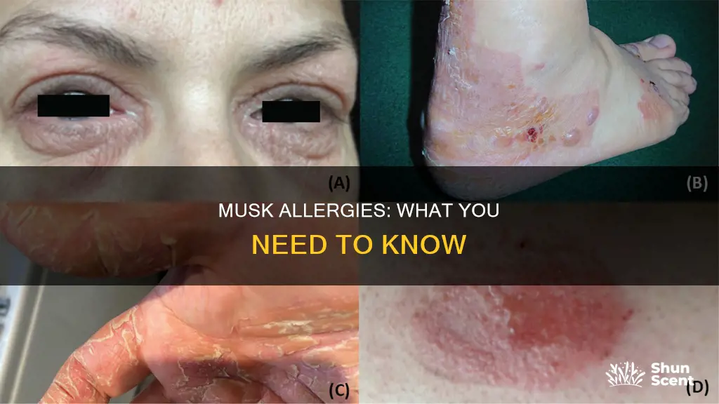 can you be allergic to the musk in perfume