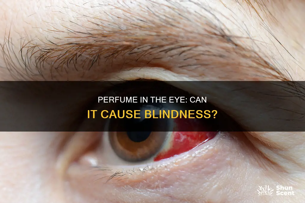 can you go blind by spraying perfume in your eye