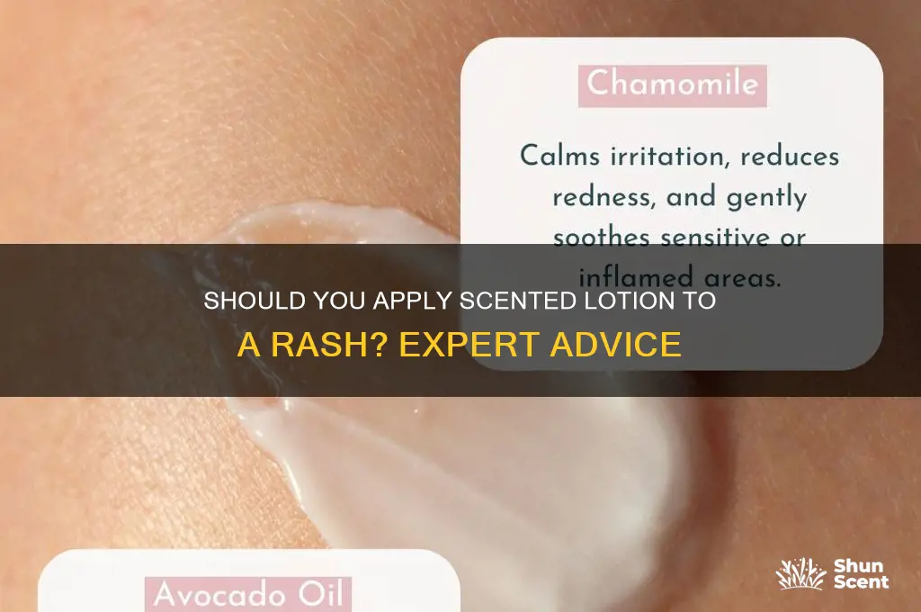 can you put scented lotion on a rash