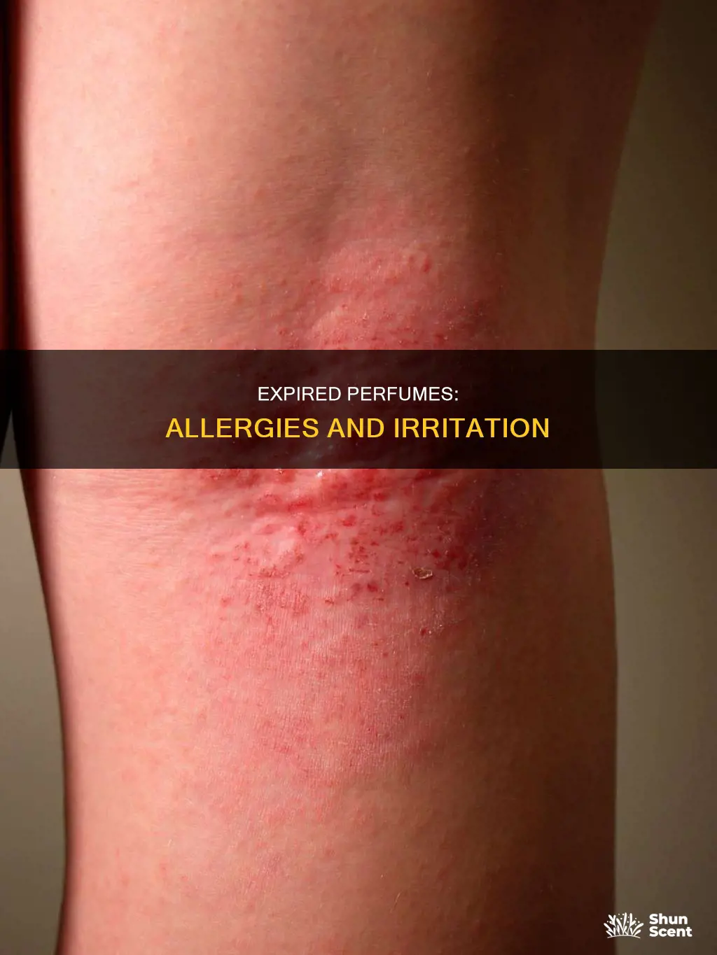 do expired perfumes cause allergic reactions