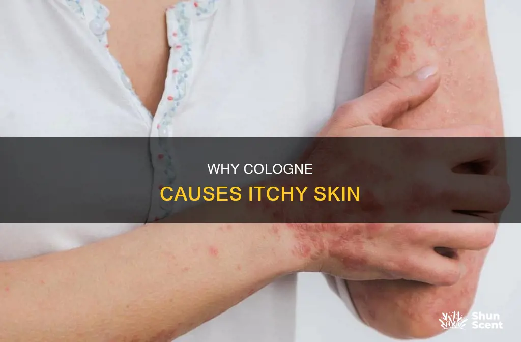 does cologne make skin itchy