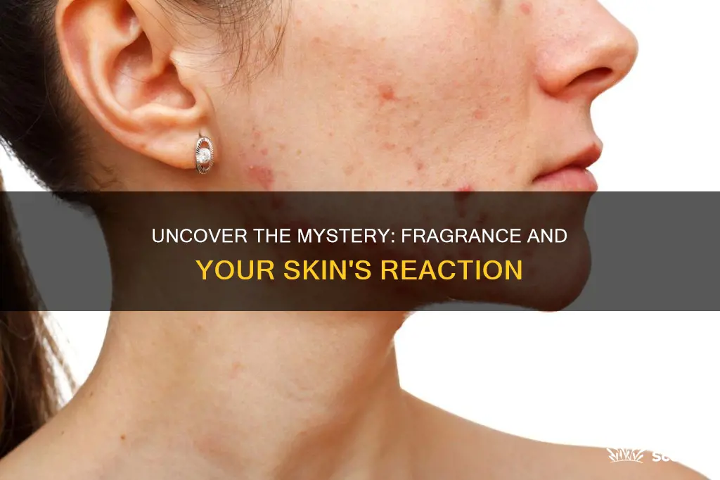 does fragrance cause breakouts