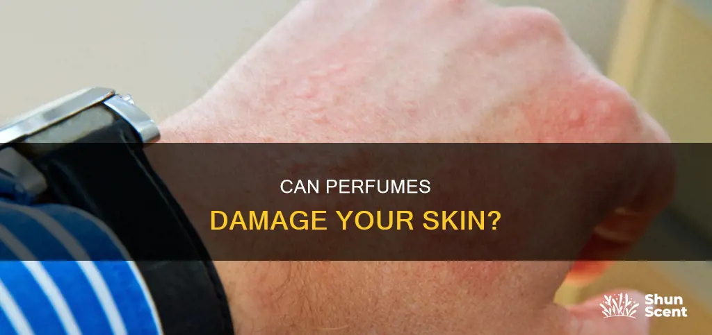 does perfume damage skin