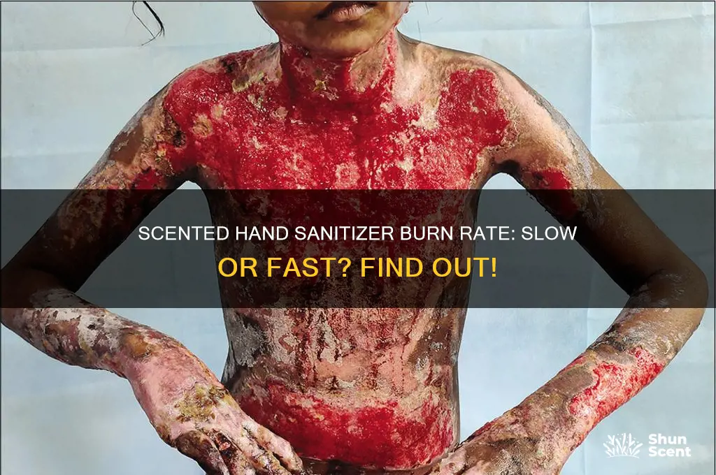 does scented hand sanitizer burn slow