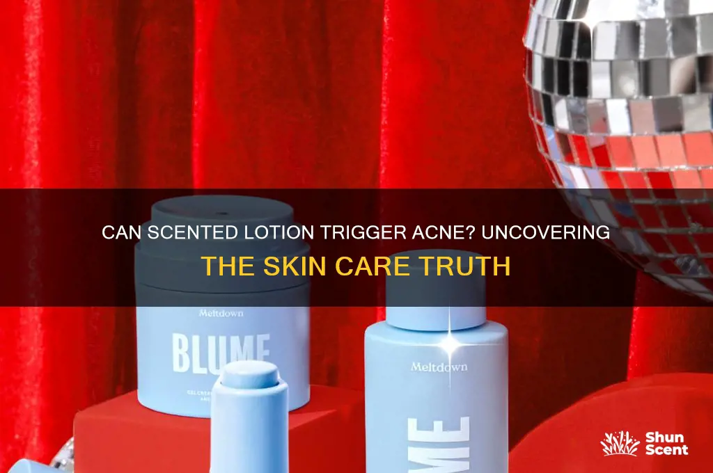 does scented lotion cause acne