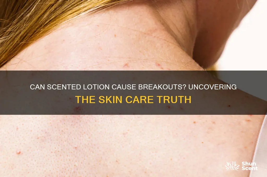 does scented lotion make you break out