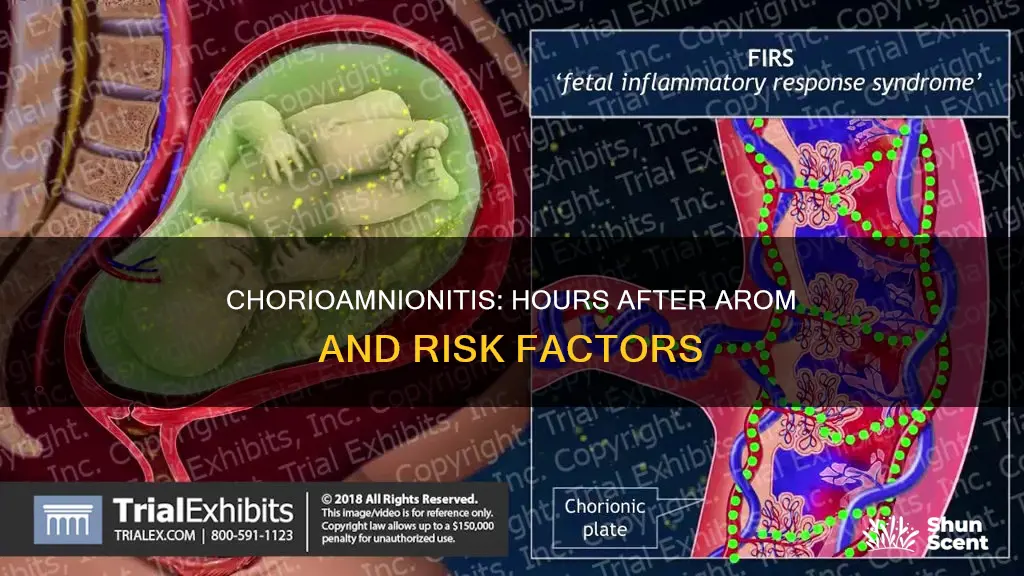 how many hours after arom can chorioamnioitis occur