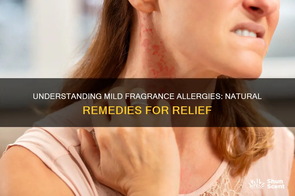 how to cure a mild fragrance allergy