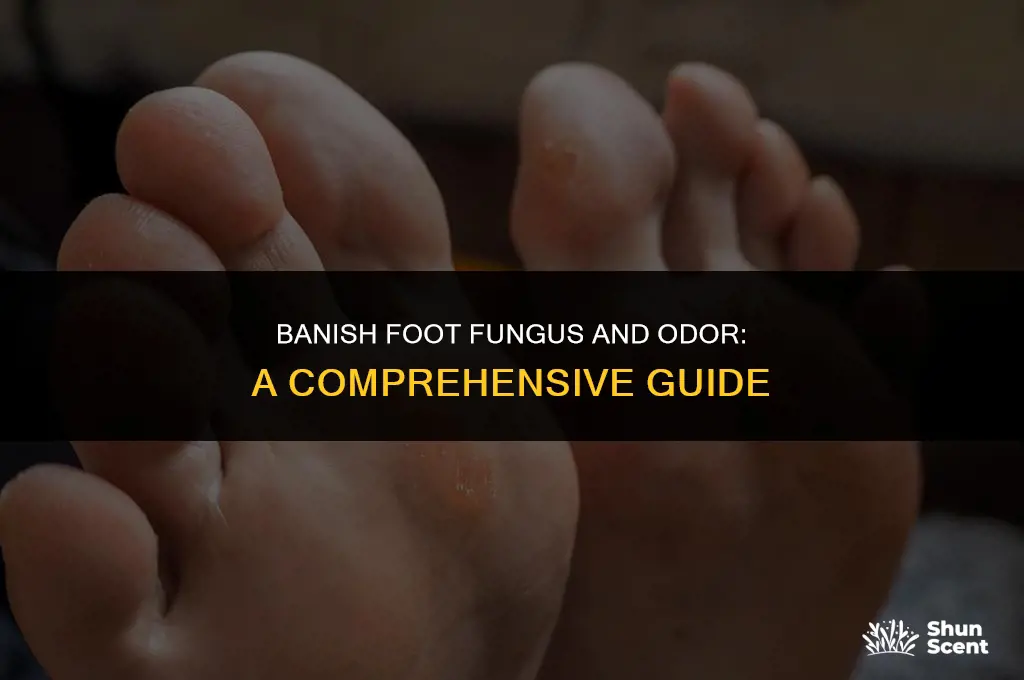 how to get rid of foot fungus and odor