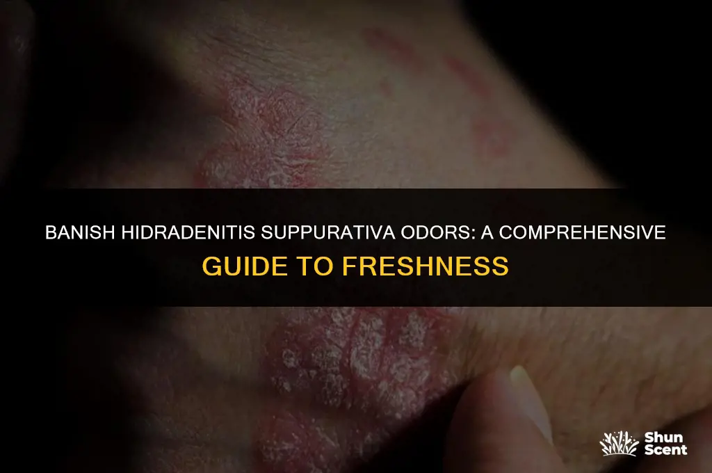 how to get rid of hidradenitis suppurativa odors