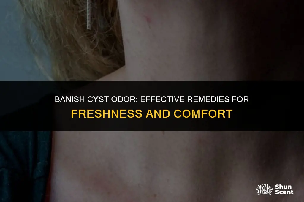 how to get rid of odor from a cyst