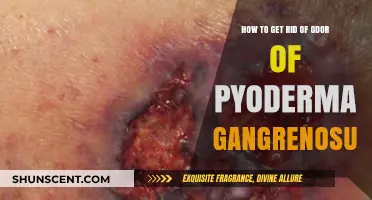 Conquering the Odor of Pyoderma Gangrenosum: A Comprehensive Guide