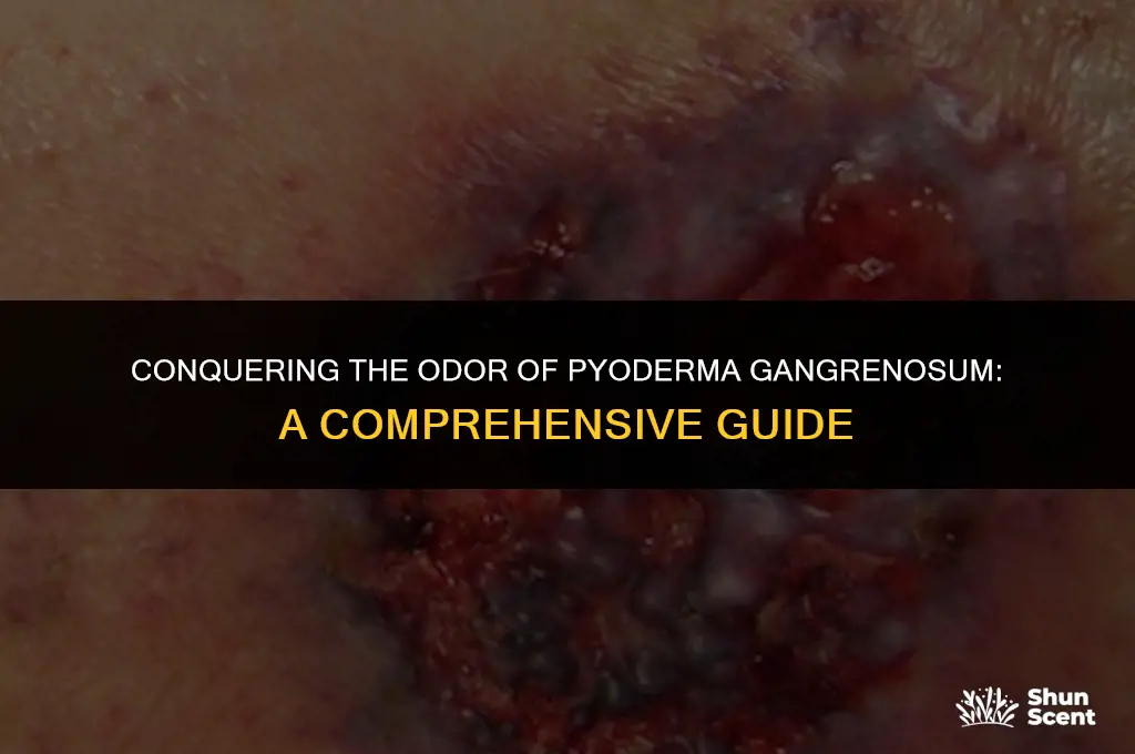 how to get rid of odor of pyoderma gangrenosum