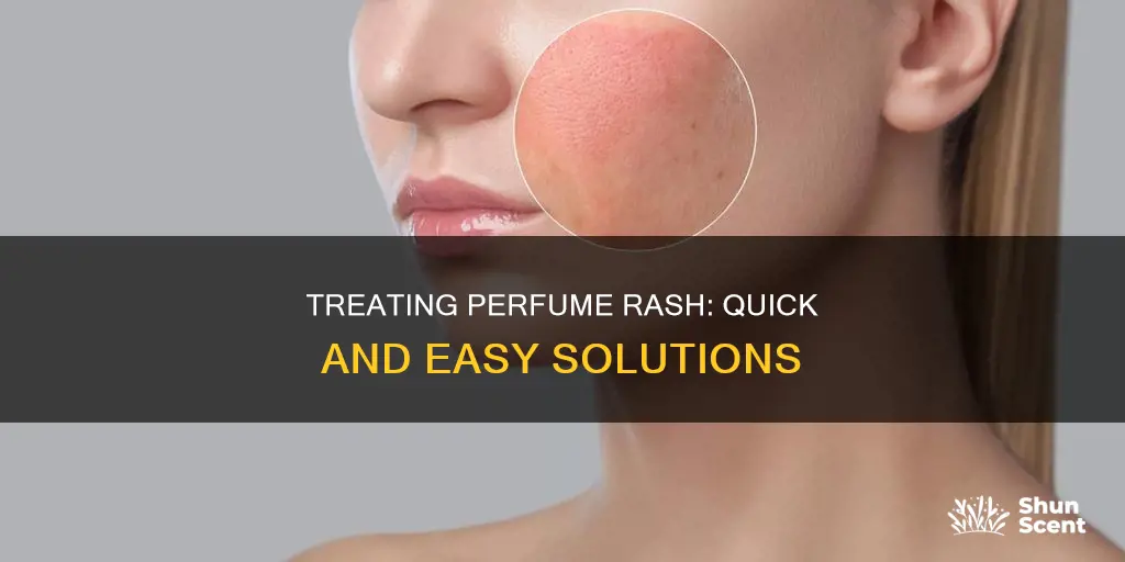 how to get rid of perfume rash