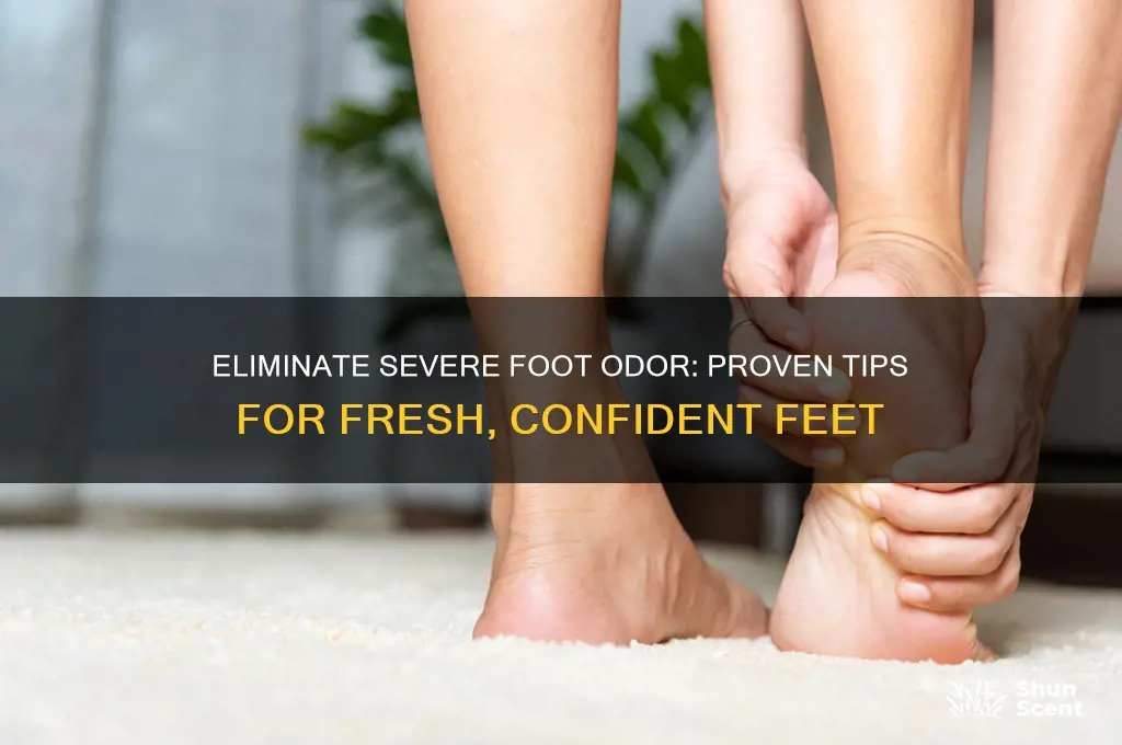 how to get rid of severe foot odor