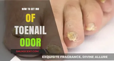 Eliminate Toenail Odor: Effective Tips for Fresh, Healthy Feet
