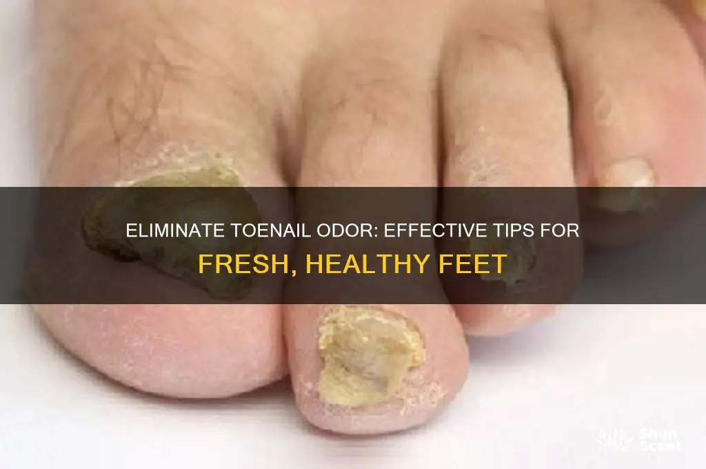 how to get rid of toenail odor