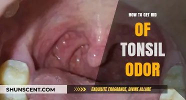 Effective Ways to Eliminate Tonsil Odor and Freshen Your Breath